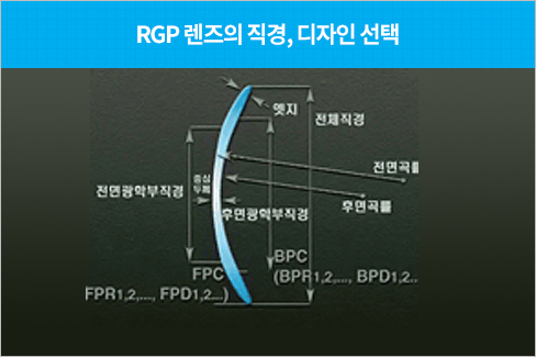 RGP 렌즈의 직경, 디자인 선택